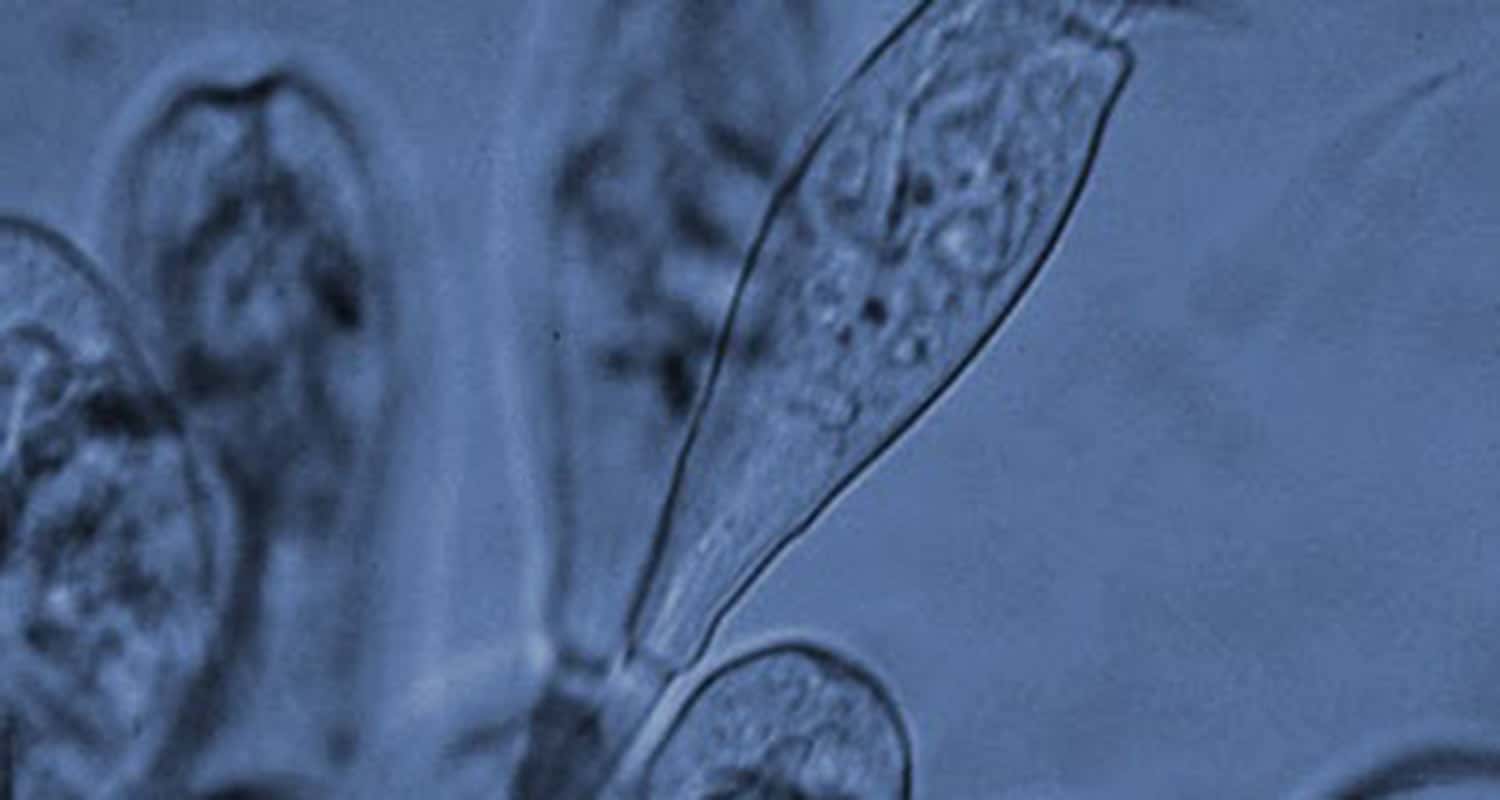 produzione-miscele-batteriche